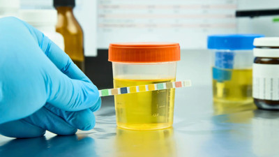 İstanbul'daki Uyuşturucu Soruşturmasında 4 Kişinin Test Sonucu Belli Oldu