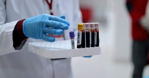 Bu kan grubuna sahip olanlar dikkat: Açıklama yapıldı