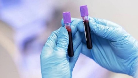 Bu kan grubuna sahip olanlar dikkat: Açıklama yapıldı