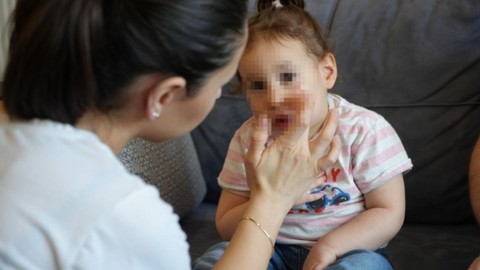 Özel Kreşte Bebeğe Darp: Aile ve Sosyal Hizmetler Bakanlığı Harekete Geçti