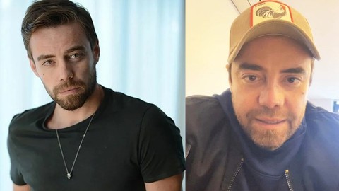 Murat Dalkılıç 11. Kez Burun Ameliyatı Oldu! İşte Son Hali...