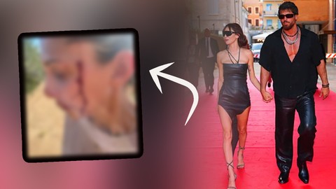 Can Yaman’ın Sevgilisinden Korkunç İtiraf! Kanlar İçinde Fotoğraflarını Paylaştı, Ortalık Karıştı
