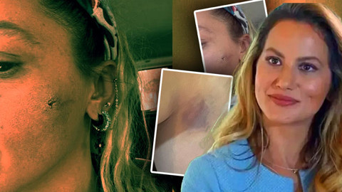 Ünlü Oyuncu Yıldız Asyalı'dan Şoke Eden Açıklama: ‘Kocam Tarafından Darbedildim’