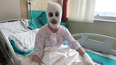 İftar Vakti 'Düdüklü Tencere' Faciası: Bomba Gibi Patladı! 'Yüzüme Dokunduğumda Et Parçası Geliyordu'