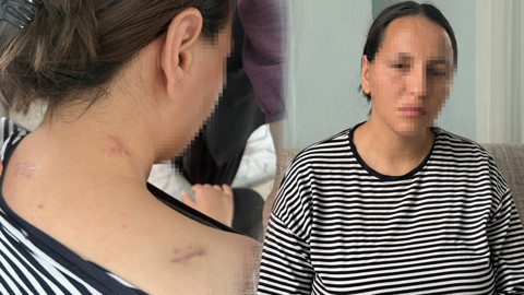 Korumayan Bir Uzaklaştırma Daha... Havva 17 Bıçak Darbesinden 'Ölü Numarası' ile Kurtuldu