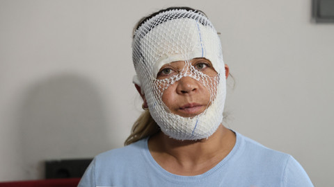 'Prenses Bakım' Değil İşkence! 7 Bin Lira Verdi, 2. Derece Yanıkla Döndü