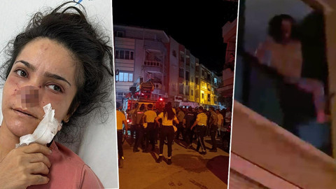 Eşi Tarafından Burnu Isırılıp Koparılan İmran Dehşeti Anlattı: 'Acıyla Balkondan Atlamayı Düşündüm'