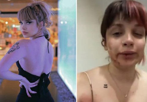 Sosyal medya fenomeni Başak Ermiş, tayt giydiği için öldüresiye dövüldü!