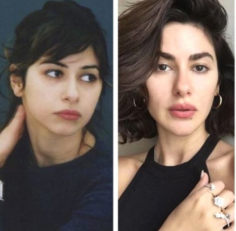 Nesrin Cavadzade meğer estetik güzeliymiş!