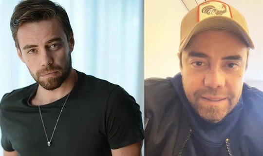 Murat Dalkılıç 11. Kez Burun Ameliyatı Oldu! İşte Son Hali...