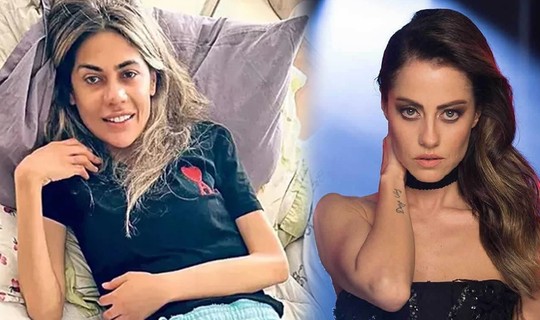 Nihal Candan'ın Ölümü Sonrası İlk Kez Anlattı! Derya Uluğ'dan 'Anoreksiya' İtirafı: 'Bir Dilim Ekmek İçin...'
