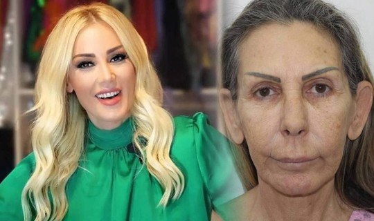 Petek Dinçöz'ün Annesi Gençleştirme Ameliyatı Oldu, Değişimiyle Herkesi Şoke Etti: 'Annesi Gitmiş, Ablası Gelmiş'