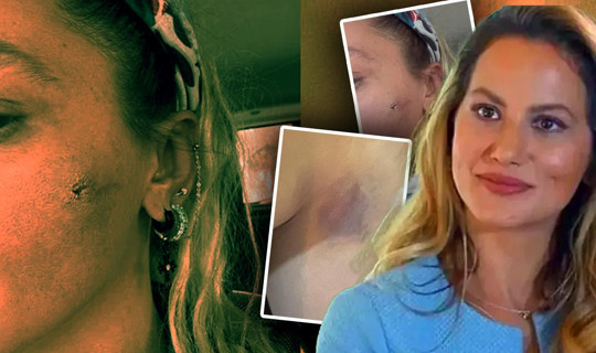 Ünlü Oyuncu Yıldız Asyalı'dan Şoke Eden Açıklama: ‘Kocam Tarafından Darbedildim’