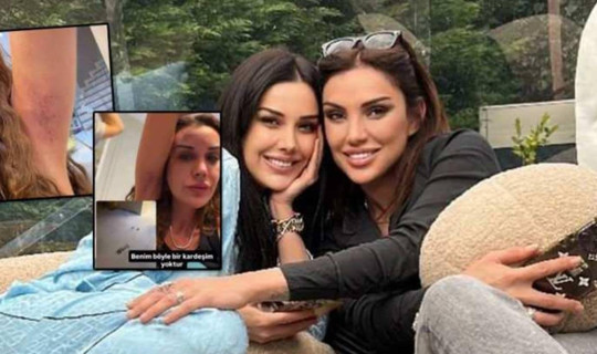 Dilan Polat İle Ablası Sıla Doğu Saç Saça Baş Başa Kavga Etti