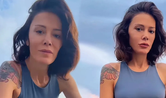 Eski Survivor Yarışmacısı Didem Ceran Yüz Nakli Yaptırdı: Yeni Haline Yorum Yağdı