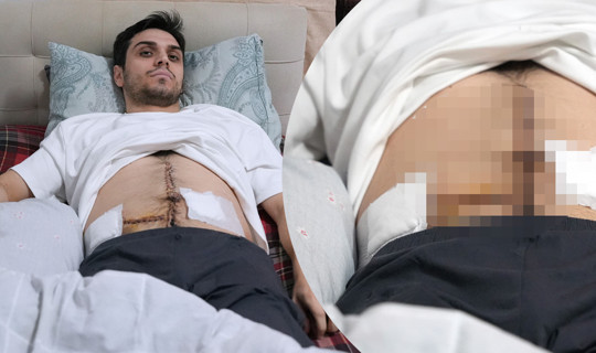 İstanbul'un Göbeğinde Dehşet! Saldırıya Uğrayan Çocuğa Yardım Etmek İstedi, 6 Yerinden Bıçaklandı