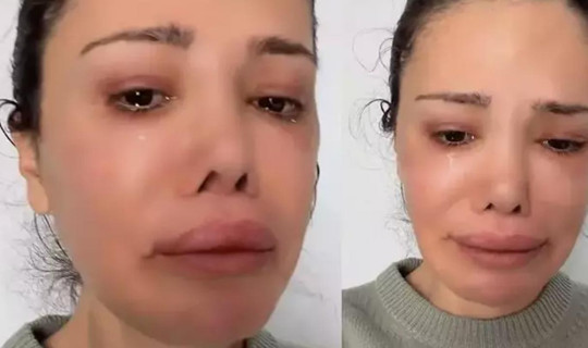 Yüz Nakli Yaptırmıştı, Didem Ceran Hastalığını Ağlayarak Açıkladı