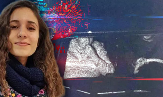 Gülistan Doku Dosyasında Kritik Detay: Şüpheli Araçta Plaka Oyunu