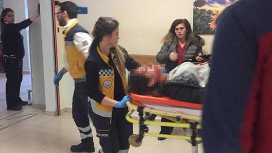 Erkek şiddeti durmuyor: Eski kız arkadaşını kafasından vurdu