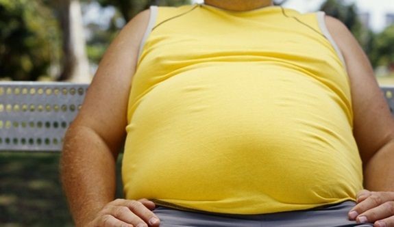 Dünyanın en obez ülkeleri açıklandı - Resim: 4