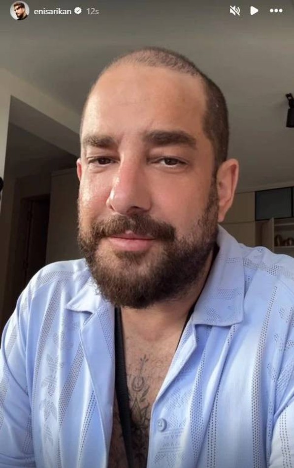 Enis Arıkan Protez Saçlarını Çıkardı, Görenler Tanıyamadı - Resim : 1
