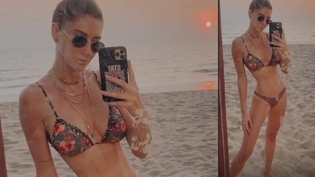 Şeyma Subaşı paylaşımıyla takipçilerini korkuttu - Resim: 2