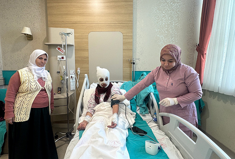 İftar Vakti 'Düdüklü Tencere' Faciası: Bomba Gibi Patladı! 'Yüzüme Dokunduğumda Et Parçası Geliyordu' - Resim : 1