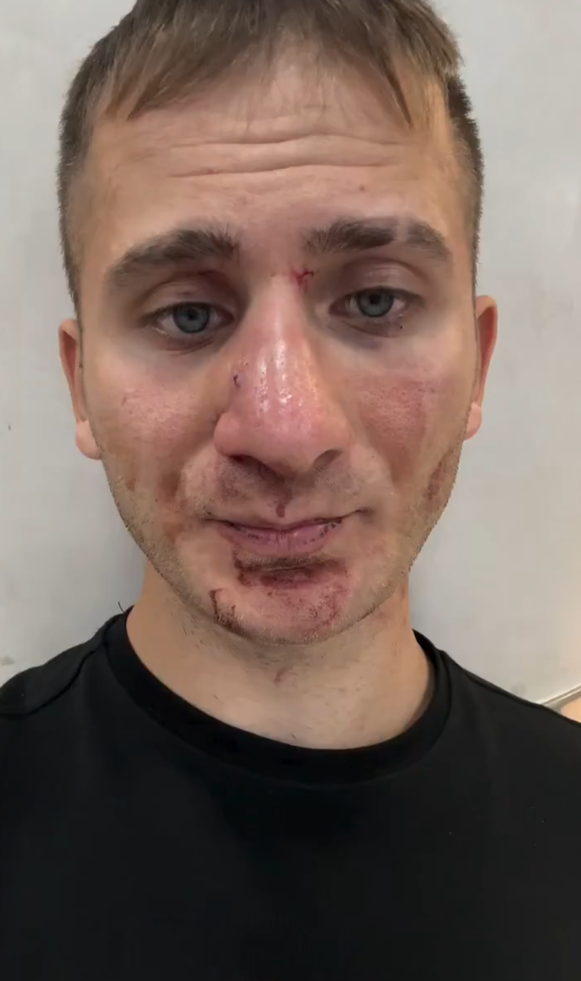 İçerik Üreticisi Taha Yaman Kılınak, Ekvador'da Hayatının Şokunu Yaşadı! Kartellerin Hedefi Oldu, Kaçırıldı, Gasp Edildi - Resim : 1