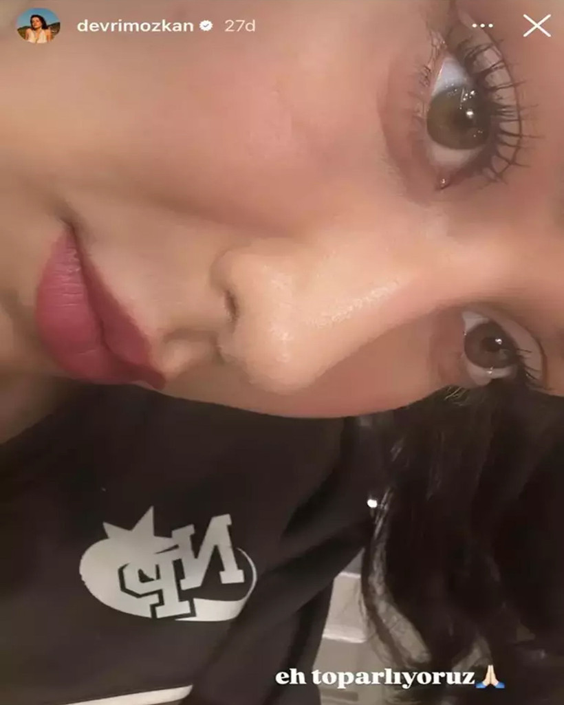 Hayranlarını Korkutmuştu... Devrim Özkan Sağlık Durumunu Açıkladı - Resim : 1