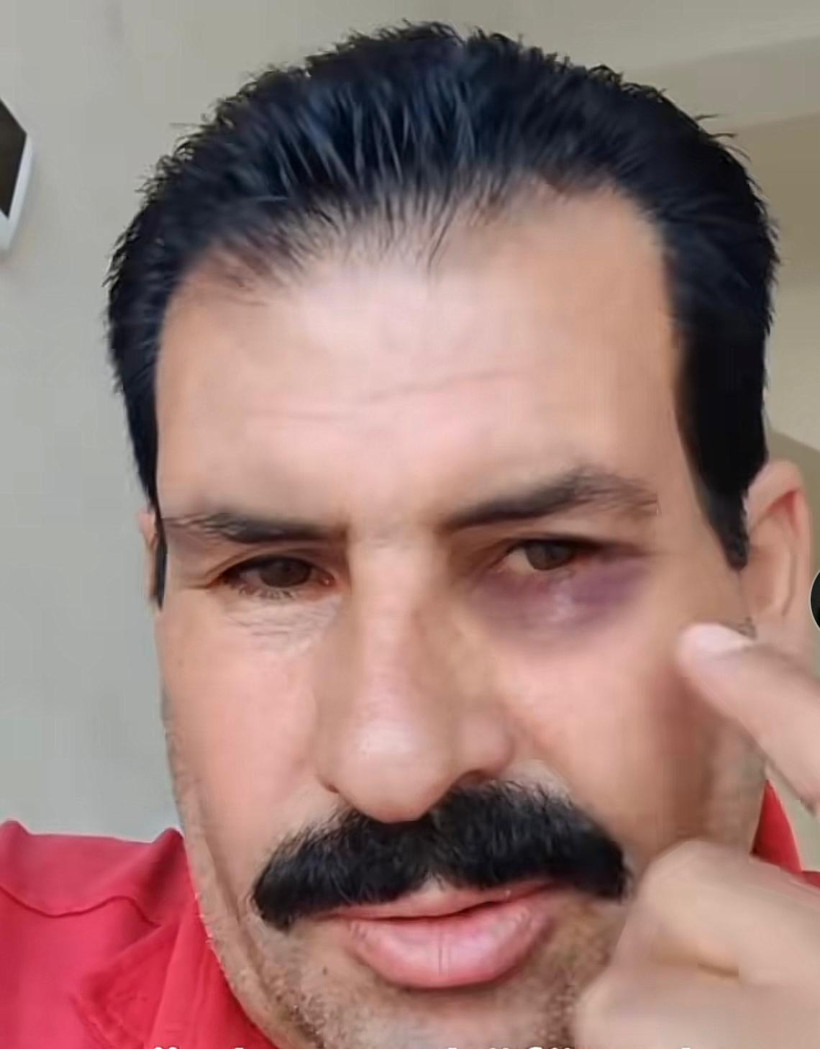 Rojin Kabaiş'e Hakarete Kelepçe - Resim : 3