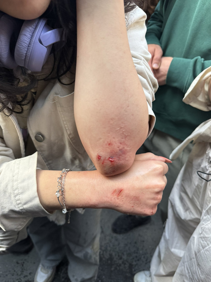 Boğaziçi Üniversitesi'ndeki 'Nureddin Yıldız' Protestolarında Gözaltına Alındı, Şiddete Uğradı! Darp Raporuna Polis mi El Koydu? - Resim : 1