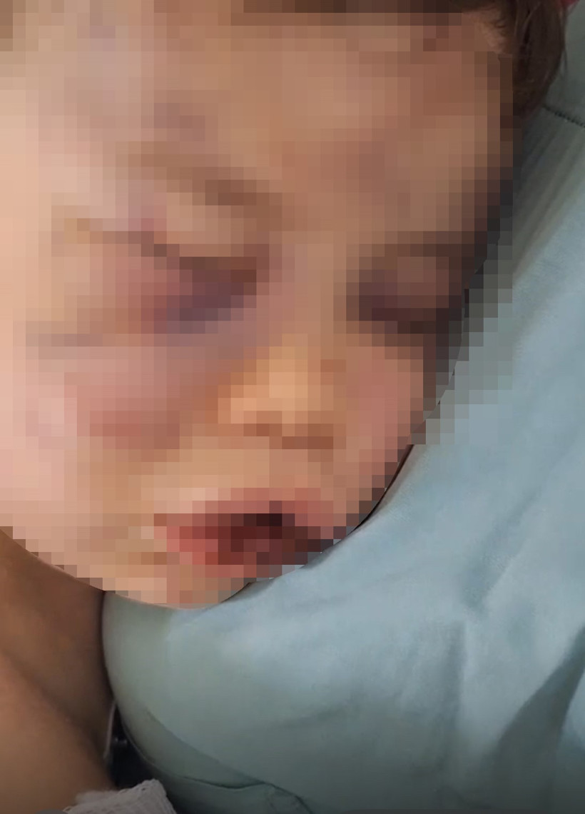 Mosmor Bir Beden, Sigara Yanıkları, Darp İzleri… Aren Bebeğin Davasında ‘Vicdan Sızlatan Anne’ İçin Yeni Talep, Doktorlar Tek Tek Anlattı - Resim : 1