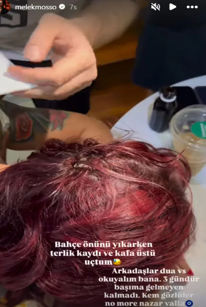 Melek Mosso Kaza Geçirdi! '3 Santim Aşağı Gelseydi Burada Olmazdım' - Resim : 2