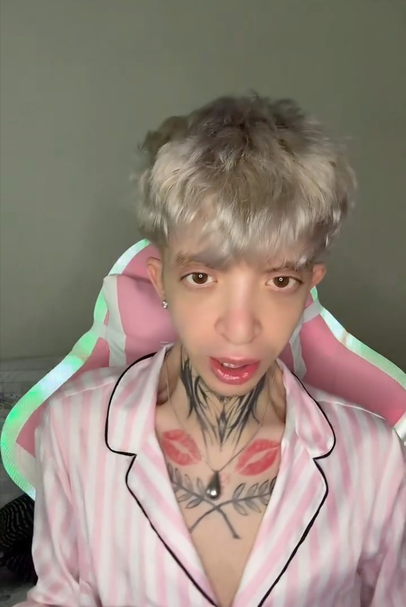 'Tablet Reis' Olarak Tanınan Fenomen Onurcan Güzel'den Yürek Sızlatan İtiraf: 'Bana Çirkin Dediniz, Ameliyat Oldum' - Resim : 2