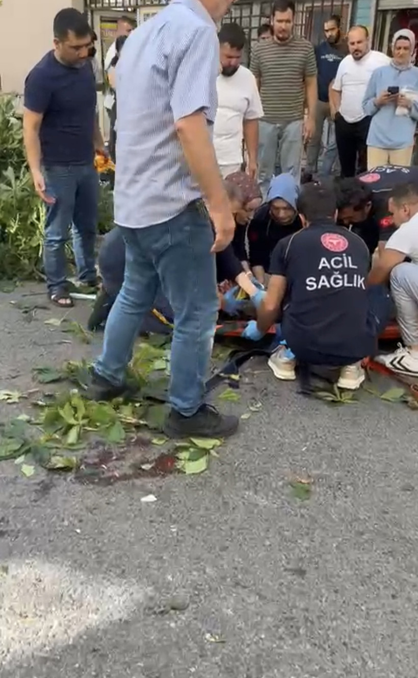 Ünlü Oyuncu İbrahim Yıldız Devrilen Ağacın Altında Kaldı, Durumu Ağır… Hastanede Ölüm Kalım Savaşı Veriyor - Resim : 1