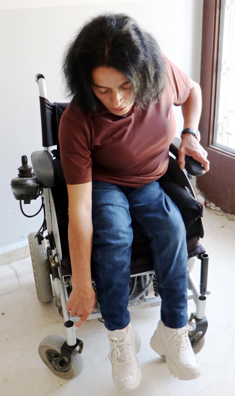 Yüzde 80 Engelli Kadına Şiddet! 'Neden Bizi Şikayet Ettin' Deyip Tekme ve Sopalarla Darbettiler - Resim : 2