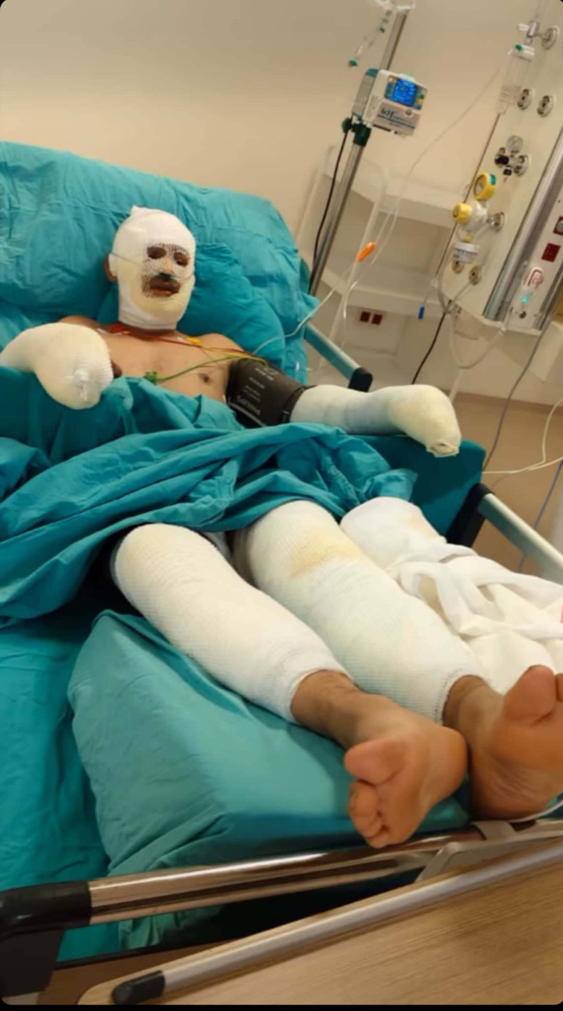 Tüm Türkiye Onu Konuşmuştu! Yangında Ağır Yaralanan Orman İşçisinden Haber Var - Resim : 3