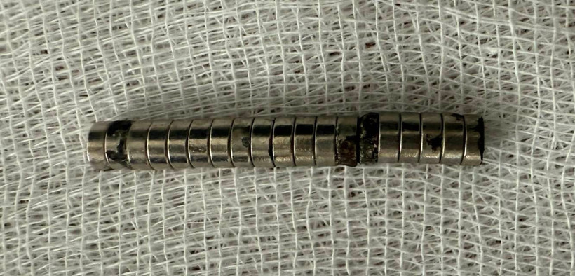 Evde Rahatsızlanan Çocuk Hastanede Herkesi Şoke Etti! Hepsi Boğazından Çıktı - Resim : 1