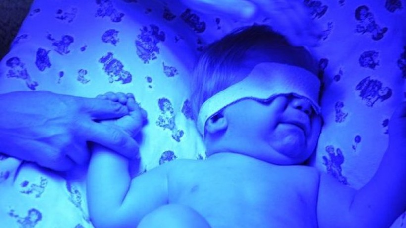Mavi bebek sendromu nedir? Belirtileri ve tedavisi…