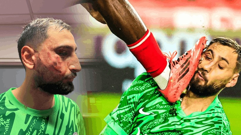 PSG'nin Yıldız Kalecisi Donnarumma'nın Yüzü Parçalandı! Kart Bile Çıkmadı