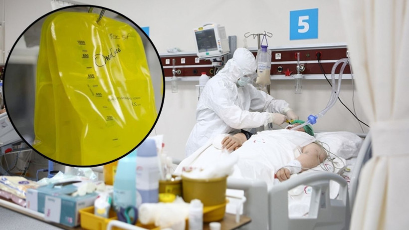 Sarı Serum Ölüm Kokteyline Döndü, Uzmanı Uyardı: Evde Rus Ruleti Oynamak Gibi