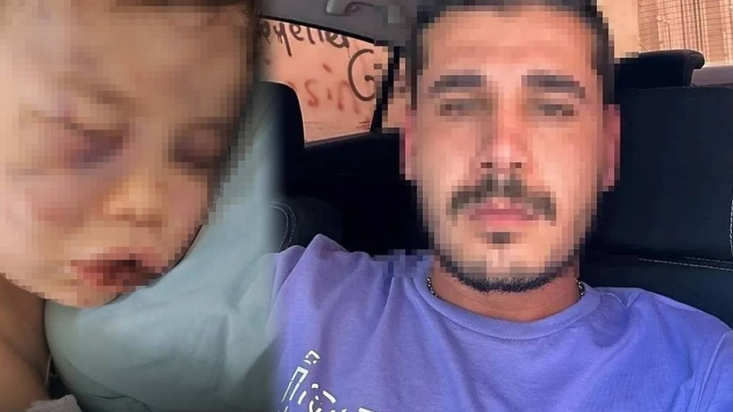 2 Yaşındaki Bebeği Darp Eden Caninin İfadesi Ortaya Çıktı