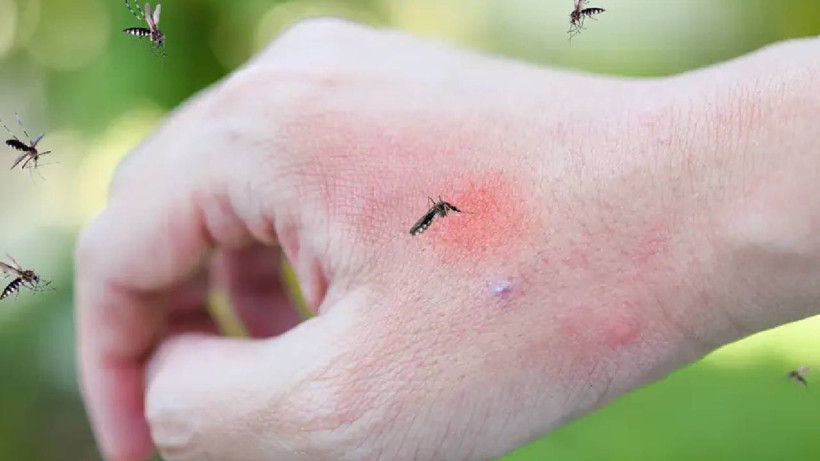 Ne Kimyasal, Ne Koku, Ne Koruyucu: Sinek ve Böceklerlerden Kurtulmanın En Etkili Yöntemi Meğer Buymuş