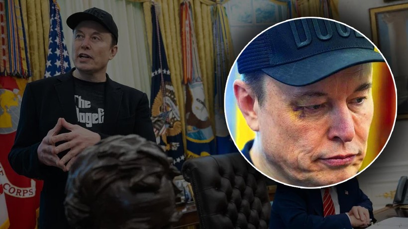 Morluklar Dikkat Çekti... Elon Musk’ın Yüzüne Ne Oldu? İlk Kez Açıkladı