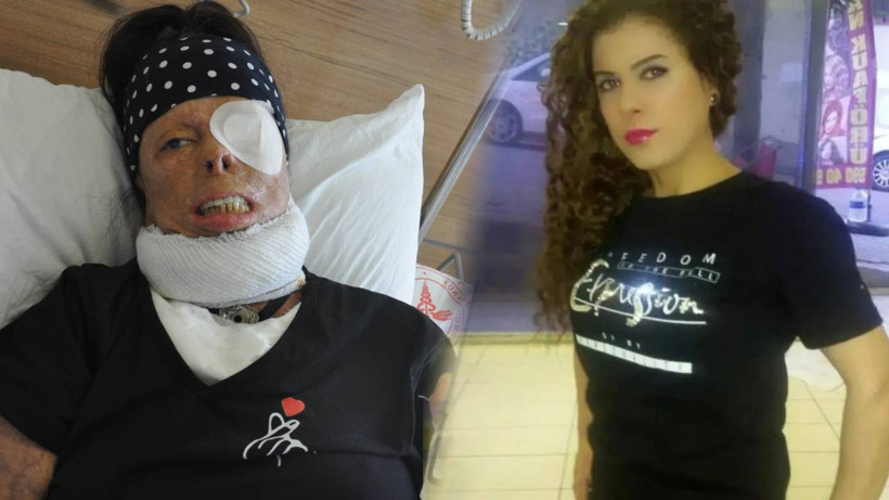 Kezzaplı Dehşet! Kıkırdakları Eridi, Gözü Aktı: Yüzünü Yıkayamasın Diye Elektriği ve Suyu Kesmiş...