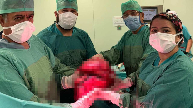 71 Yaşındaki Kadının Karnından 9 Kiloluk Kitle Çıkarıldı