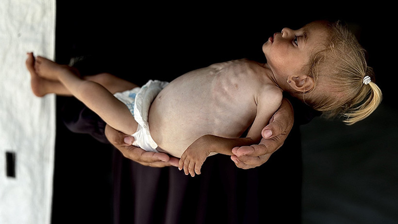 İsrail'in 'Kıtlık' Saldırısı: Gazze'de Bir Bebek Daha Açlıktan Öldü