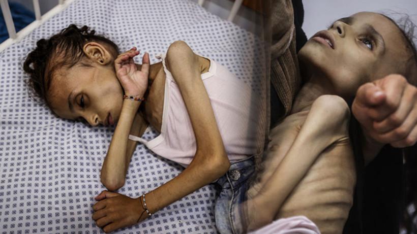 Gazze'deki İnsanlık Dramı Derinleşiyor... 10 Kiloluk En Ağır Vicdani Yük...