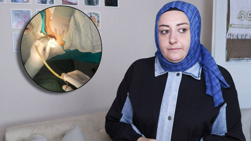 Doğumdan 7 Ay Sonra Karnından Hortum Çıktı! Başhekimin Pişkin Cevabı Şoke Etti: 'Ölmedin, gelseydin hallederdik'