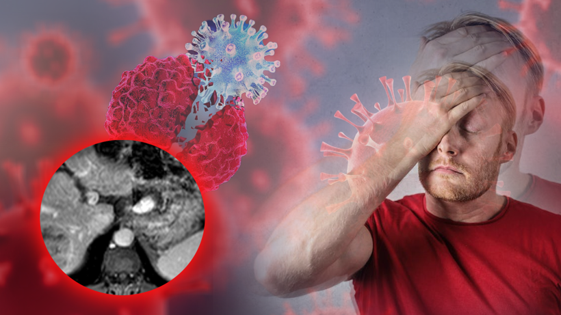 Sessizce Yayılıyor, Ölümcül Yeni Pandemi Alarmı! 2050’de 1,5 Milyon Vaka Bekleniyor